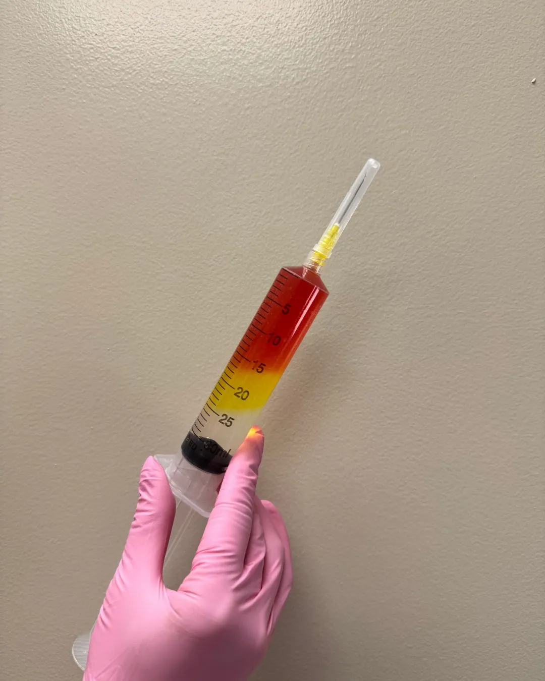 IV Pushes in Torrance, CA | Nutrient Injection Therapy IV Pushes in Torrance, CA | Nutrient Injection Therapy