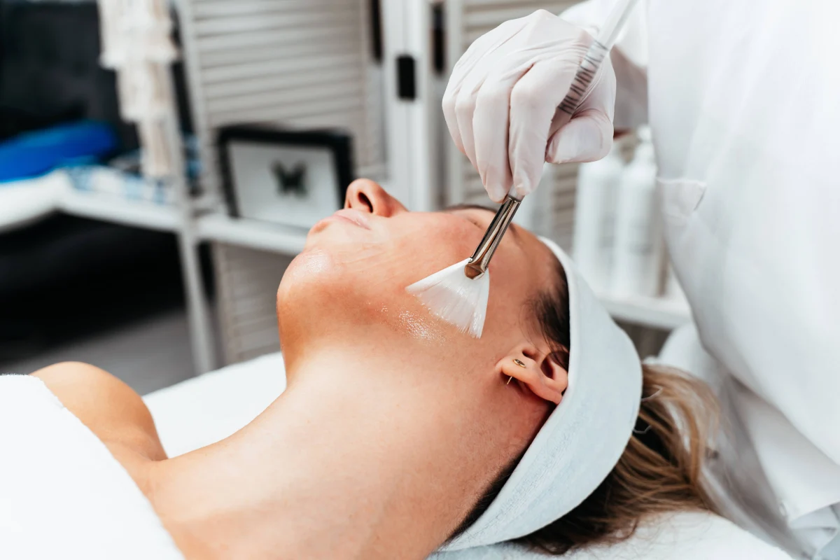 Woman receiving a VI Peel Precision Plus treatment in Torrance at SIBÉL Aesthetics.